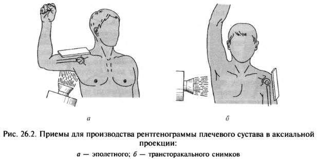 Проекции рентгена